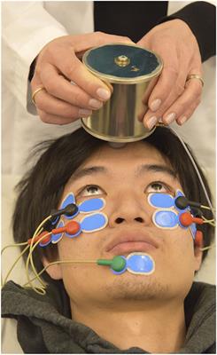 Diagnosing Myasthenia Gravis With Repetitive Ocular Vestibular Evoked Myogenic Potentials